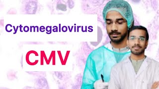 Cytomegalovirus (CMV) | Transmission | Manifestation | Diagnosis | Treatment