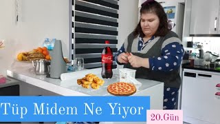 Bir Günde Tüp Midem Ne Yedi| 20.Gün🍳