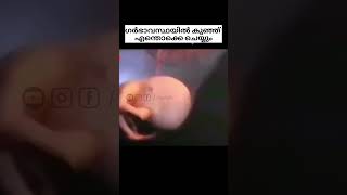 Happy Baby in womb 💯#shorts #trending #pregnancy #malayalam #funny #newvideo
