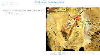 AVJRT (AVNRT) Ablation - sample from EP in Practice