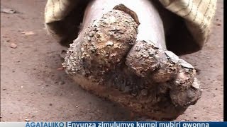 Envunza zimulumye kumpi mubiri gwonna