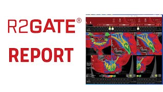 R2Gate Report Usage and interpretation