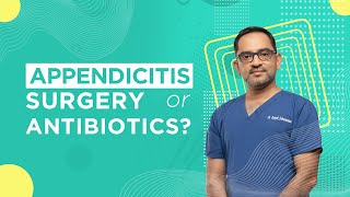 Appendicitis: Surgery or Antibiotics?