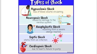 Mnemonics to remember Types of Shock; Hypovolemic, Cardiogenic, Septic, Anaphylactic, Neurogenic