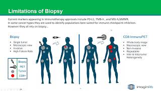 QUIBIM WEBINAR | Cancer Immunotherapy  Exploring Imaging as a Catalyst to Immune Response Prediction