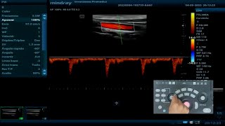 Z50 Mindray | Instalación y Configuración ✅