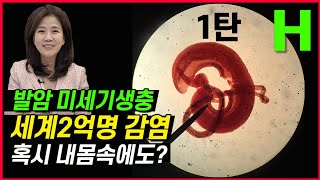 기생충약 언제 먹을까? 기생충이 암 당뇨의 주범이라는데...현황과 진실. 시리즈1탄(총3회)