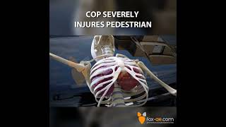 Cop Severely Injures Pedestrian