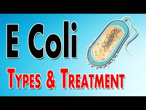 How do you classify E coli?