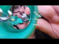 ASMR - chaotic medical exams 🩺💊