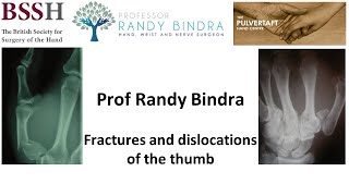 Fractures and dislocations of the thumb by Prof Randy Bindra