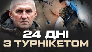 ВИЖИВ З МУМИФІКОВАНОЮ РУКОЮ. ПІХОТИНЕЦЬ 57 ОМБр “АЛЕКС”: “У МЕДИКІВ ОДВИСАЛА ЧЕЛЮСТЬ”