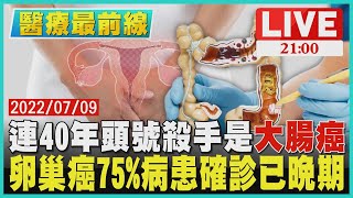 【2100 醫療最前線】連40年頭號殺手是「大腸癌」　卵巢癌75%病患確診已晚期