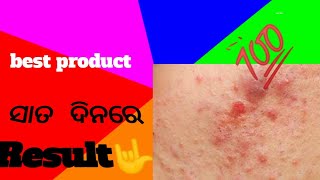 ଯେତେ ପୁରୁଣା ବ୍ରକମିବଣ 7 ଦିନରେ 😯ବ୍ରଣ କେମିତି କମିବ😯100%#viral #trending@rupapin2khushiexpress443