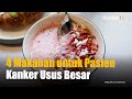 4 Makanan yang Baik untuk Pasien Kanker Usus Besar | KONTAN Info Sehat