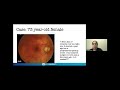 diseases of the vitreomacular interface and macula