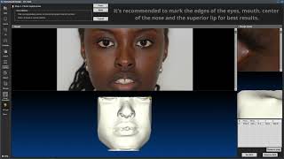 [OnDemand] 3D Ceph (Photo Mapping & Landmarks)