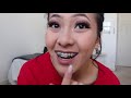 Quick Q&A  All About my Braces ♡ Cynthia Lee