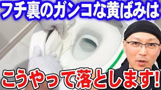 フチ裏のガンコな黄ばみはこうやって落とします！