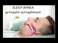 sleep disorders தூக்கக் கோளாறுகள் தூக்கத்தில் என்னவெல்லாம் பிரச்சனை நடக்குது தெரியுமா by philo