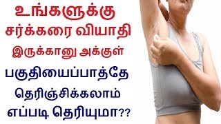 சர்க்கரை வியாதி உங்களுக்கு இருக்க இல்லையாயென அக்குள் பகுதியை பார்த்து எப்படி தெரிந்து கொள்வது?