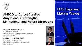 AI-ECG to Detect Cardiac Amyloidosis: Strengths, Limitations, and Future Directions