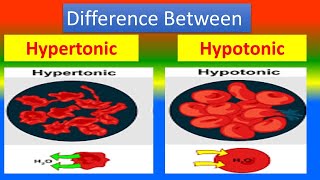 Difference between Hypertonic and Hypotonic