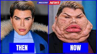 35 Stars Who Completely Ruined Their Faces With Plastic Surgery Disasters | Then and Now Photos 2026