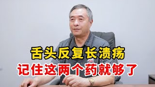 舌头反复长溃疡 记住这两个药就够了