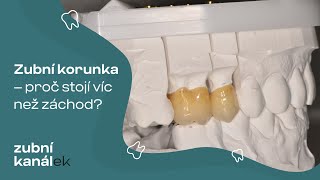 Zubní korunka - proč stojí víc než záchod?