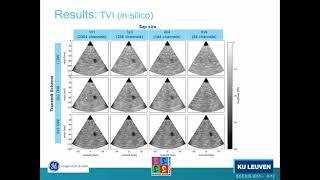 High Frame Rate 3D Tissue Velocity Imaging Using Sub-Aperture Beam Forming