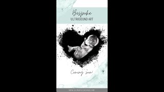 Bespoke Ultrasound Art - Coming Soon! Digitally Watercolored Sonogram \u0026 IVF Embryo Designs. Mom Gift