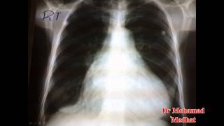 Cardiology CXR Dr Mohamad Medhat