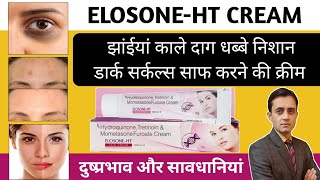 झांईया काले दाग धब्बे निशान साफ करने की क्रीम / Elosone ht cream review in hindi