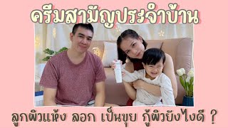 ลูกผิวแห้ง ลอก เป็นขุย ดูแลฟื้นฟูผิวอย่างไร #ภูมิแพ้ผิวหนัง | #แม่อยู่ตรงนี้ I’m here for you.