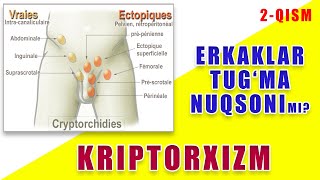 ERKAKLAR TUG'MA NUQSONI. KRIPTORXIZM 2-QISM