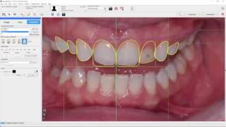 DSD2D Software Tutorial 7/8