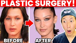 Plastic Surgeon Reacts to BELLA HADID Cosmetic Surgery Transformation!