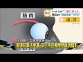 車禍舊傷今確診 球王桃田右眼窩底骨折休養三個月－民視新聞