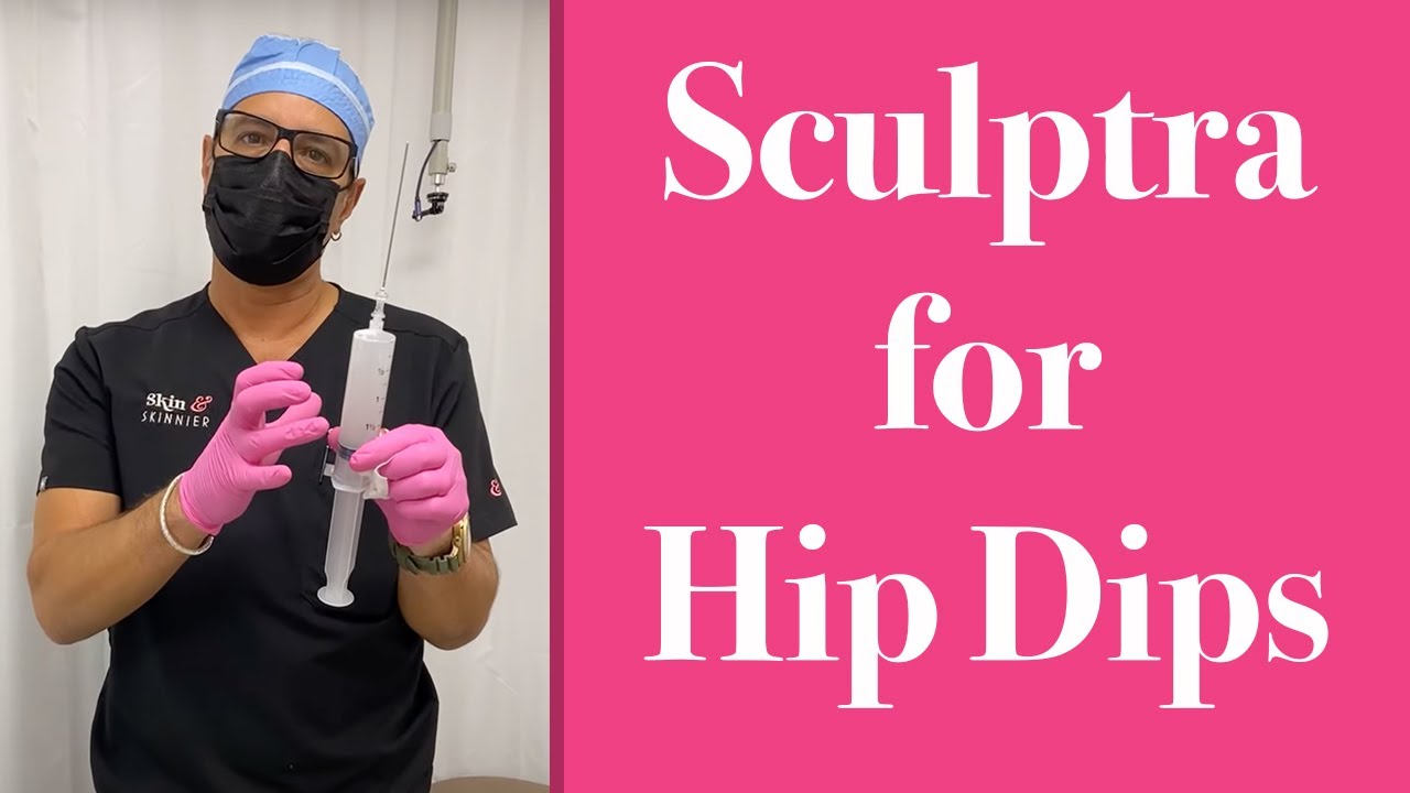 Sculptra For Hip Dips - Skinny BBL San Diego 🍑 - YouTube