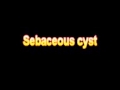 What Is The Definition Of Sebaceous cyst Medical School Terminology Dictionary