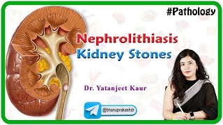 Nephrolithiasis  / Kidney stones : Types, Clinical features, Diagnosis and Treatment (Hindi)