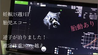 【妊娠35週3日】なんとか逆子直りました！【胎児エコー＆胎動】