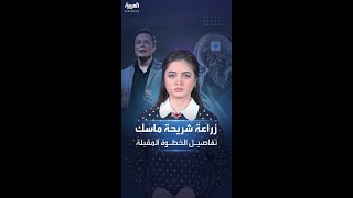 ماذا بعد زراعة أول شريحة في دماغ إنسان؟