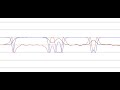 1D sine-Gordon equation model