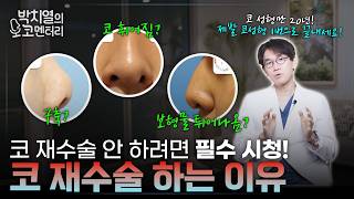 코 성형 한번에 끝내려면 의사들의 미감이 중요하다고?!