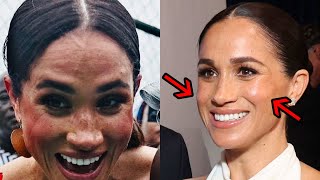 Just Chattin' - Harry \u0026 Meghan:  Cosmetic Procedures? Medical Experts Weigh In