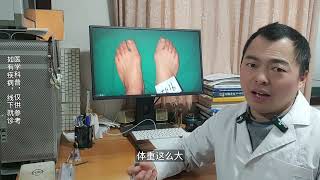 hallux valgus 青少年拇外翻怎么办？大陆哪里做拇趾外翻