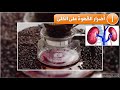 عشرة اضرار عن القهوة من الواجب معرفتها