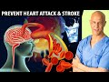 🚰The Best Times to Drink Water to Prevent HEART ATTACK & STROKE | Dr. Mandell